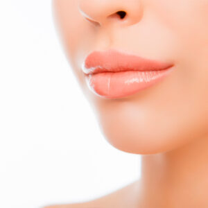 plump lips - lip augmentation - boss md plastic surgery - bergen county